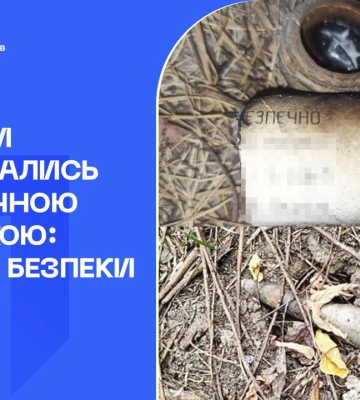 На Житомирщині через спалах невідомого предмета постраждав підліток