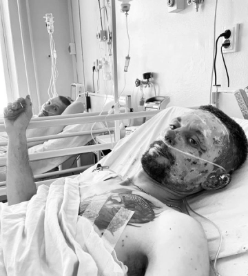 Тричі мав померти: у Дніпрі врятували важкопораненого воїна ЗСУ