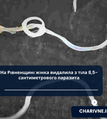 На Рівненщині жінка видалила з тіла 8,5-сантиметрового паразита