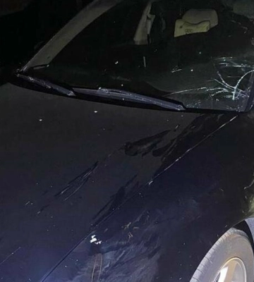 На Полтавщині автомобіль Audi наїхав на пішохода: останнього госпіталізували до лікарні