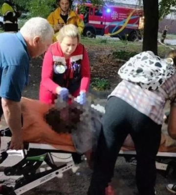 У Дніпрі на Савченка палала квартира: постраждала жінка