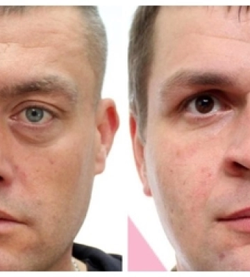 Поліція розшукує двох зниклих безвісти лучан 