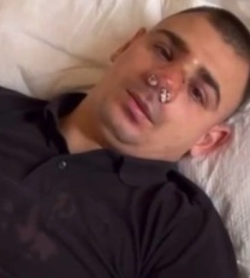 Хлопець заявив, що його побили в Києві &quot;слуги народу&quot;: фото, відео і всі подробиці