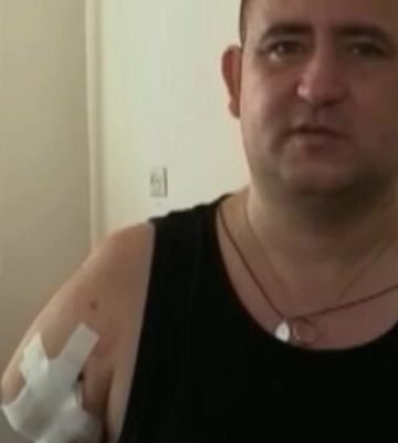 Втратив обидві руки. Морпіх Олександр Пікуль потребує допомоги