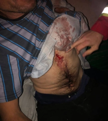 На Волині ліквідовують горіння торф&#039;яника