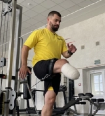 «Побратиму, якого рятував – ногу врятували, а мені відрізали»: історія бійця з Сарн