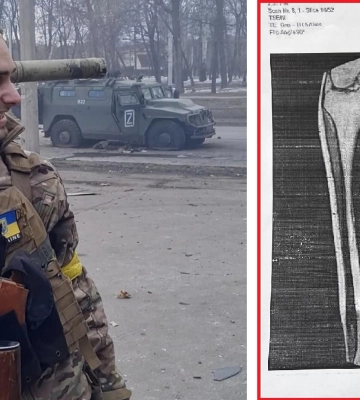 "Надо было отрезать ногу": Харьковскую МСЭК ждет проверка из-за скандала с военным