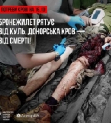 У Рівному та Херсоні – велика потреба у донорах крові усіх груп