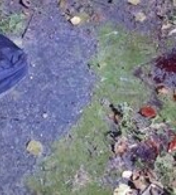 В центре Киева мужчину трижды ударили ножом, полиция разыскивает подозреваемых – фото