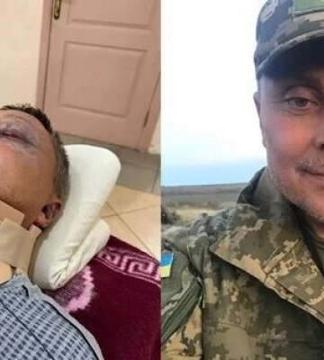 На Одещині жорстоко побили військового