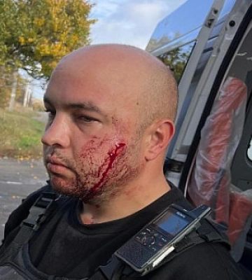 Напав на поліцейського з ножем, поранив його та себе: затримали мешканця Дніпропетровщини