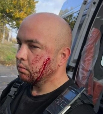 На Дніпропетровщині чоловік із ножем напав на поліцейських