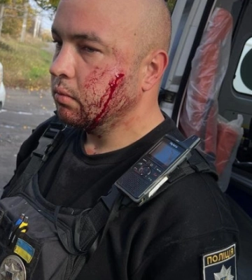 Напал на полицейского с ножом, ранил его и себя: задержали жителя Днепропетровщины
