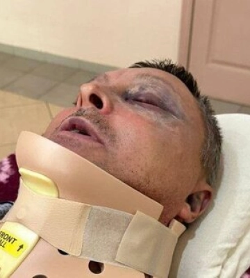 Помер військовий, якого побила група людей на Одещині