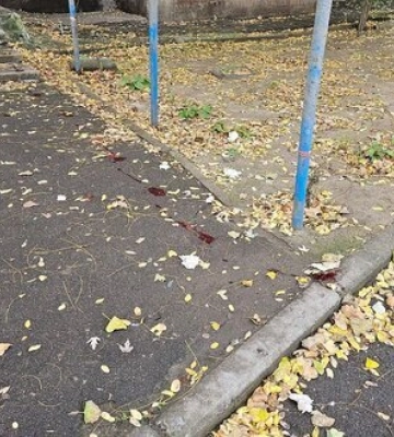 Оккупанты снова обстреляли Херсон, ранены четыре человека. Фото