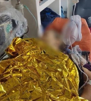 Окупанти з артилерії обстріляли прикордоння Сумщині - є загибла
