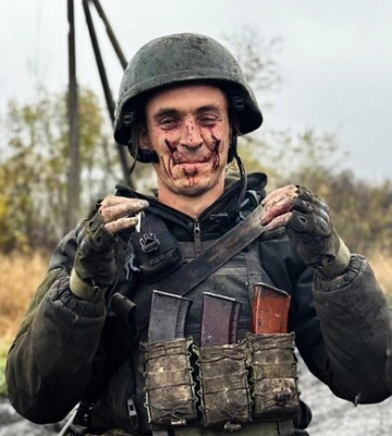 Обличчя війни: захисник запорізького краю гвардієць Андрій після штурму ворожих позицій