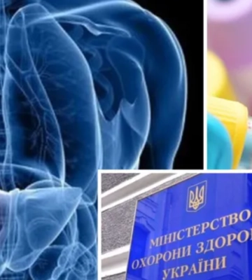 Чому гепатит А швидко поширюється та чи є загроза епідемії в Україні