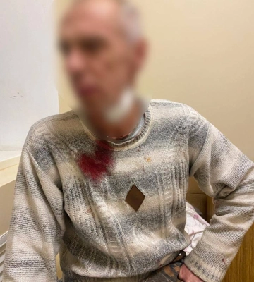 Житель Харьковщины во время застолья чуть не убил мужчину: подробности