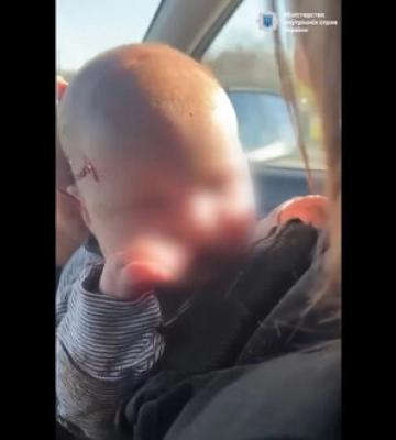 Травмированной при обстреле Херсона двухмесячной девочке ничего не угрожает, ее мама - в тяжелом состоянии, - ГВА