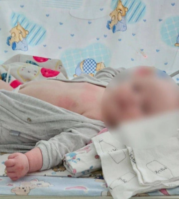 Жінку та двомісячну дівчинку, які вчора потрапили під обстріл у передмісті Херсона, евакуюють до Одеси