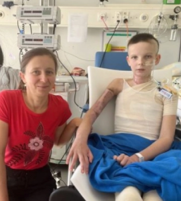 Забавки із бензином. Хірурги врятували дівчинку із важкими опіками