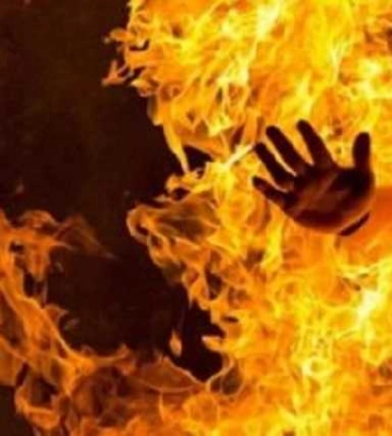 На Волині чоловік підпалив себе на вулиці. Фото 18+