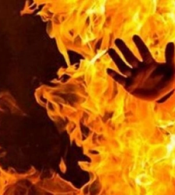 На Волині 65-річний чоловік сам себе спалив: що відомо