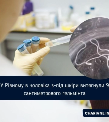 У Рівному в чоловіка з-під шкіри витягнули 9 сантиметрового гельмінта