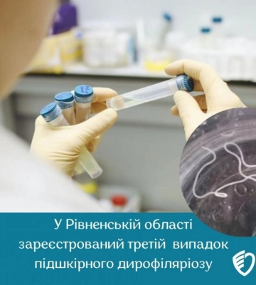 У Рівненській області зареєстрований третій у цьому році місцевий випадок підшкірного дирофіляріозу