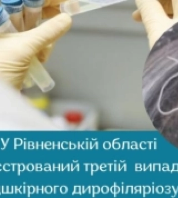 У Рівненській області зареєстрований третій у цьому році місцевий випадок підшкірного дирофіляріозу