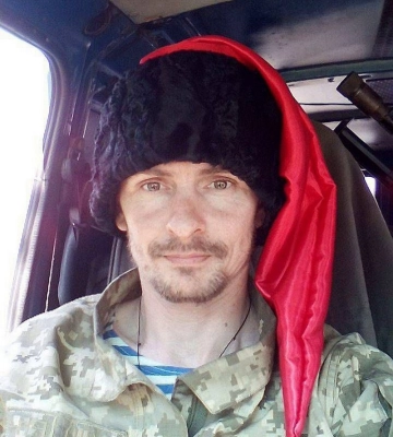 Захиснику з Черкас потрібна операція на обличчі