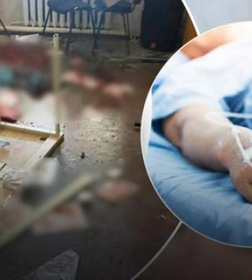 На Закарпатье депутат взорвал три гранаты, есть пострадавшие в тяжелом состоянии, – СМИ