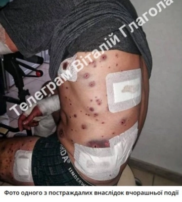 Теракт на Закарпатті: депутат-підривник прийшов до тями, його допитує поліція