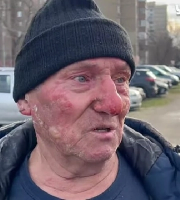 Получил ожоги: в Киеве мужчина во время массированной атаки сел в горящее авто, чтобы отогнать его