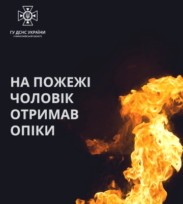 Через пожежу в котельні опіки отримав житель обласного центру