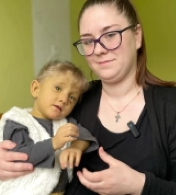 У Львові почали лікувати дітей із синдромом Алажиля, який руйнує печінку (Відео)