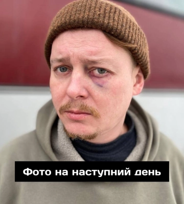 &quot;Вот это съездили на гастроли&quot;: в Днепре директор театра избил актера из Чернигова