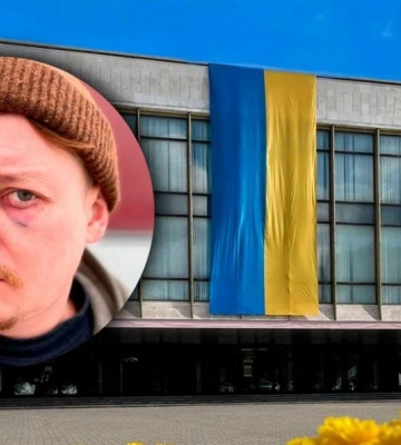 У Дніпрі побили актора Миколу Лемешка, були погрози "прострелити коліно": що каже поліція та директор театру, якого звинувачують в&amp;hellip;