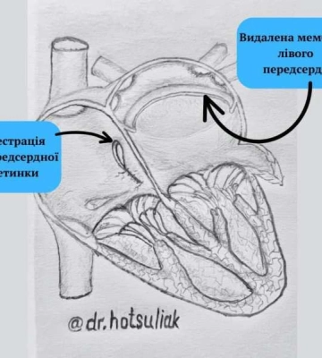 В Одесі прооперували дитину з рідкісною аномалією серця
