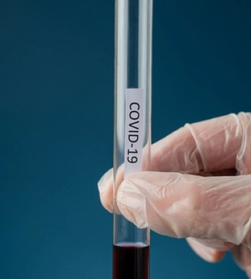 У грудні по світу зафіксували 10 тисяч смертей від COVID-19