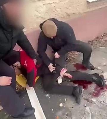 На Херсонщині поліцейські з Миколаєва та Полтави оперативно допомоли підлітку, якого поранило під час ворожого обстрілу