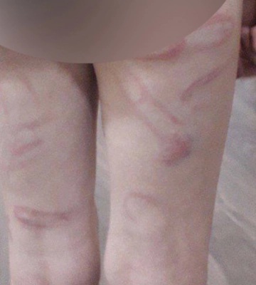 У Чернівецькій області вихованка закладу жорстоко побила 9-річну дитину: реакція Лубінця