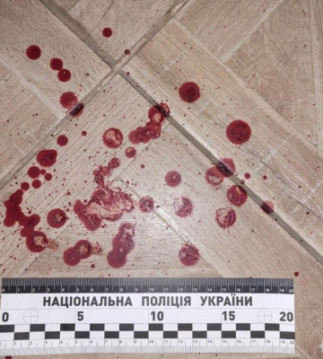 У Рівному сусідська сварка закінчилася різаниною