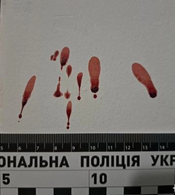 У Рівному сусідська сварка закінчилася різаниною