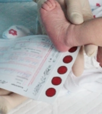 На Рівненщині провели понад 9,5 тисяч досліджень з неонатального скринінгу