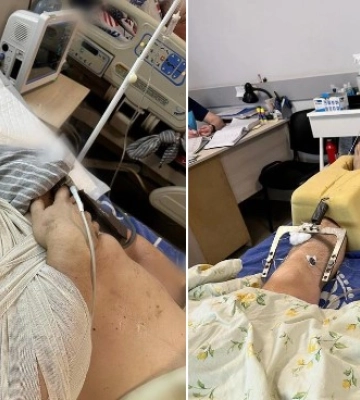 У Сумах рідні просять допомогти важко пораненому під час обстрілу поліцейському