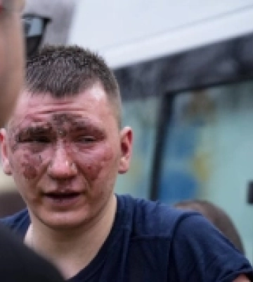 Ракетна атака по Одесі: постраждали щонайменше 20 людей, рятувальники показали фотографії