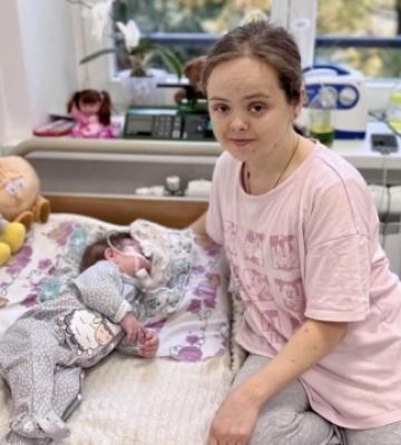 Львівські лікарі прооперували дівчинку з рідкісним синдромом П’єра-Робена