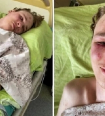 На Закарпатті дівчина військовозобов'язаного, що намагався вчинити самогубство у воєнкоматі, звернулась до поліції